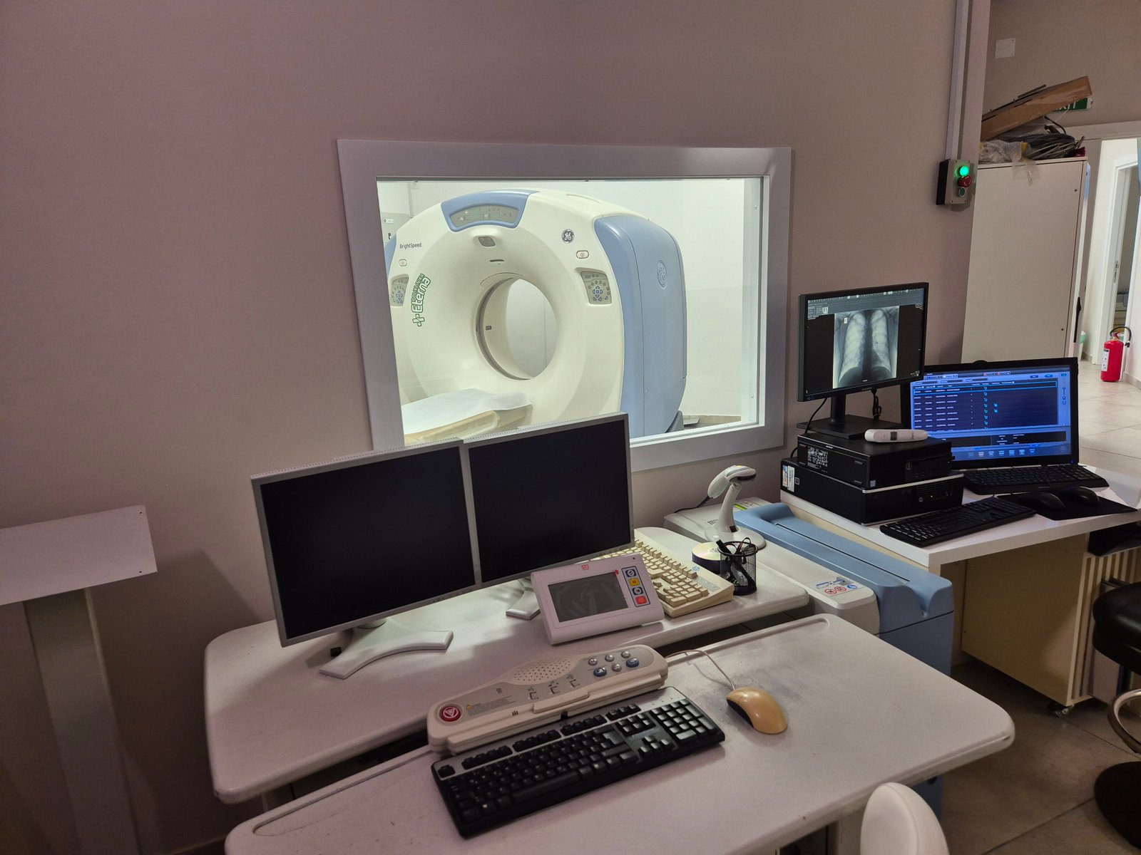 CT dijagnostika